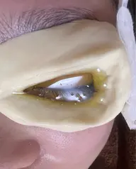 ネトラバスティ&ヘッドスパ40分