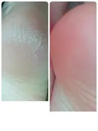 足裏ぷるぷるケア