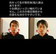 美容整体≪オススメ≫