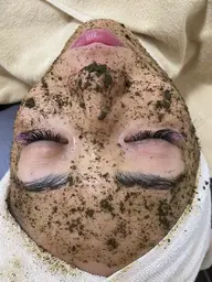 最強の肌改善🌿肌質改善🔥医療レベルの効果大🔥【剥離ありorなしオーダーメイドでお肌に合った選択】ハーブピーリング！