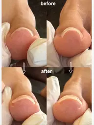 期間限定✨【1本¥4500➡️¥2000〜3000】➕デザイン(合計¥13000〜15000)