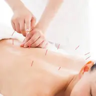 🍄限定メニュー🍄全身鍼　メンズも対応可