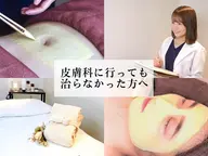 [ニキビ跡特化メニュー]居座るニキビ跡を撃退👊イオンピーリング＋スペシャル鎮静パックで新しい肌へ(マッサージ付き)