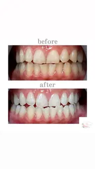 【メンズ専用クーポン】40分照射➕カウンセリング※口コミ必須