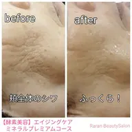 最強スペシャルエステ誕生♥️【ミネラル酵素美容* エイジングケアコース】 ハリ✨艶✨くすみ✨