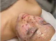 女性　フェイスシュガーリング+ハイドロジェリーマスク