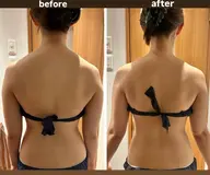 【人気】頑固なセルライト&凝りに❤️🔥ラジオ派で深部温め&吸引で癒着を剥がし、デトックス!心身共に整います✨