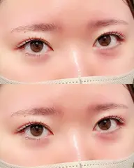 【人中短縮効果💗】似合わせまつ毛パーマ➕下まつ毛パーマ　(ケラチンTR＋束間コーティング付き💫)