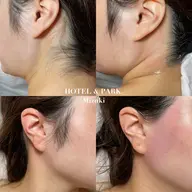 ミニモ学割🍒【うなじ＋もみあげワックス脱毛】卒業式、前撮りに◎