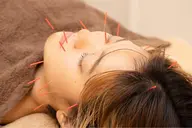 【minimo限定】🪡お悩みに合わせて選べる2種類の美容鍼🪡最小限の刺激で最大限の効果を🫧