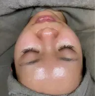 【無針リジュラン】水光肌🇰🇷話題の生サーモン美容液を導入🦋🫧