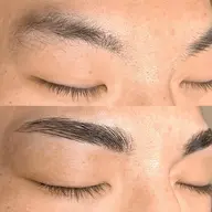 ハリウッドブロウリフト（HBL）