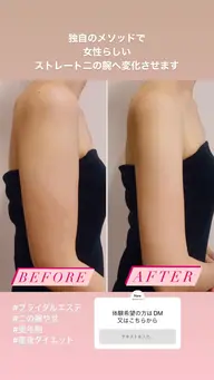 二の腕痩せ 体験