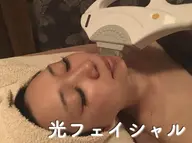 お試し光フェイシャル