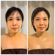 【たるみ・二重アゴ・ほうれい線 改善 】リフトアップエステ