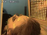 【赤み・くすみケア】光美容LED×美容鍼×EMS