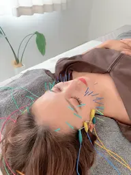 【新規初回限定】小顔になれる美容鍼の定番コース🪡