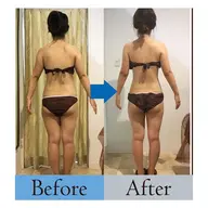 【痩身マシンで脂肪にアタック】2パーツ上限ショット照射＆揉みだし発汗