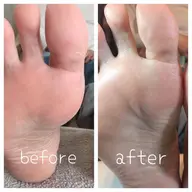 フット⭐︎足裏角質ケア