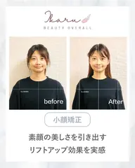 【初回体験】小顔矯正＋ヘッドスパ＋顎関節調整（30分） ¥7000→¥3500