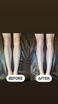 ✨メンズ✨両脚　ワックス脱毛　太ももから下￥11000✨