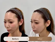 フェイスラインのお悩み解消ヘアアート（SMP）