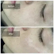 《男性》清潔感UP！フェイスワックス🫧(シートパック付／高保湿モデリングパック変更可)１度で効果を感じられます🥚✨