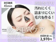 毛穴ケア🤩鼻だけカーボンピーリング👃✨