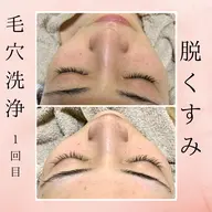 【毛穴洗浄】毛穴に悩んでいませんか？