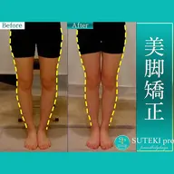 【下半身バランス整体】美脚ライン《骨盤矯正＆美脚大転子矯正》 ￥6600→ カウンセリング含む全体45分