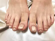 footオーロラ🩵ミラーネイルモデル💅オフなし