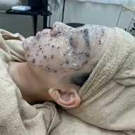 【ハイドロ・カーボキシー】お肌改革クーポン🌸