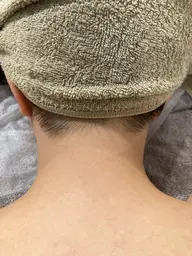 部分脱毛(Sパーツ)(2回目以降割引)口周り、うなじ、手・足の甲、ひざ。