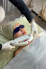 女性限定✨フェイシャル綺麗脱毛5回¥38,500/ 化粧ノリUP・毛穴ケア