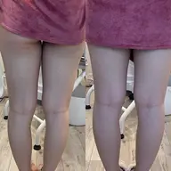 学割U24🌼ラジオ波ですっきりボディ