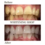 【再来の方限定】40分照射×口コミ特典！1回¥6,980→《特別価格》でご案内