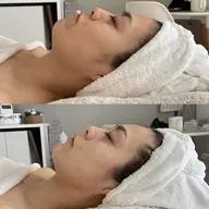 痛くない小顔矯正💆ビューティコネクト■筋膜をはがしながら顔ツボをとらえてしっかり流すオールハンド小顔 60分