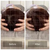 今話題の脳洗浄🌈頭の浮腫を取り除きます!下記料金は通常料金です。モニター価格にて予約の受付開始しております✨