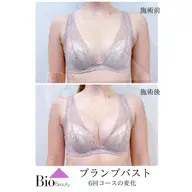 【通常価格／都度払い】プランプバスト★ふっくら綺麗なバストライン ¥58,000