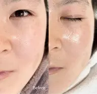 毛穴クレンジングエステ