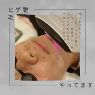 メンズ men'sひげ脱毛【ミニモ限定メニュー】