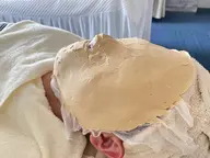 小顔矯正石膏パック・リフトアップ⤴️・定着コース