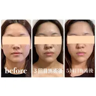 【口コミ投稿&ビフォーアフター掲載許可でお得‼️】