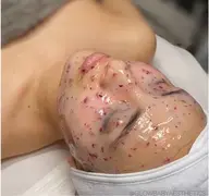 【毛穴洗浄で毛穴レス✨】ハイドラ毛穴洗浄で皮脂汚れスッキリ！