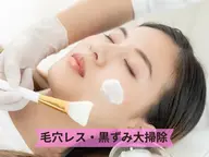 【毛穴ホワイトスノーピール】即効で毛穴レス肌！潤い美白肌へ¥8500→¥7000