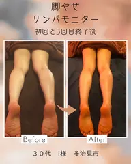 【脚やせモニター様募集❤️】ナノカレントコアボディサポーターでほっそり脚♡背中と脚のリンパ45分❤️