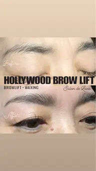 ハリウッドブロウリフト