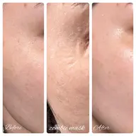 【カーボキシー炭酸ガスパック＋ゾンビマスク＋ハイドロジェリーマスク】最強スペシャルセット☆