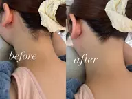 土日祝限定🎊人気No.1施術のうなじ脱毛(シェービング付)自己処理NG❌デザイン提案得意