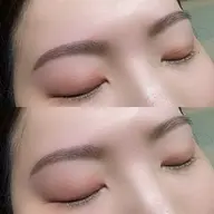 アイブロウ脱毛